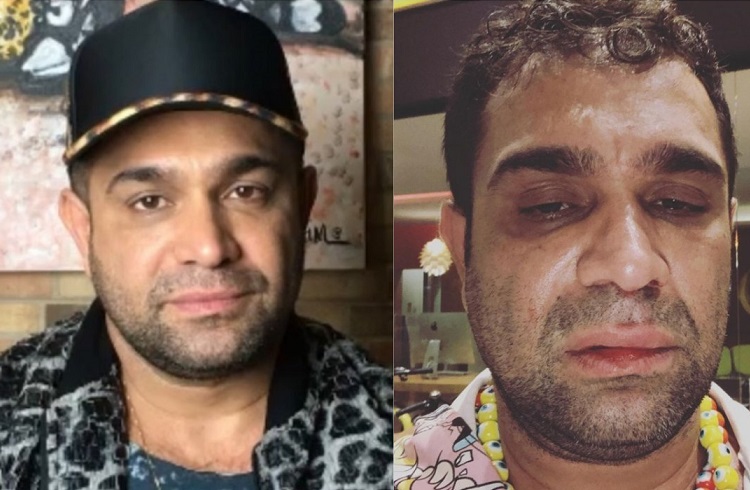 Evandro Santo relata agressão após show: "Homofobia e covardia"